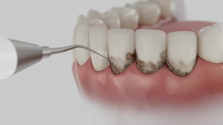 Trusted Wisdom Tooth Removal service in Scenic, AZ - Dentist Open Now